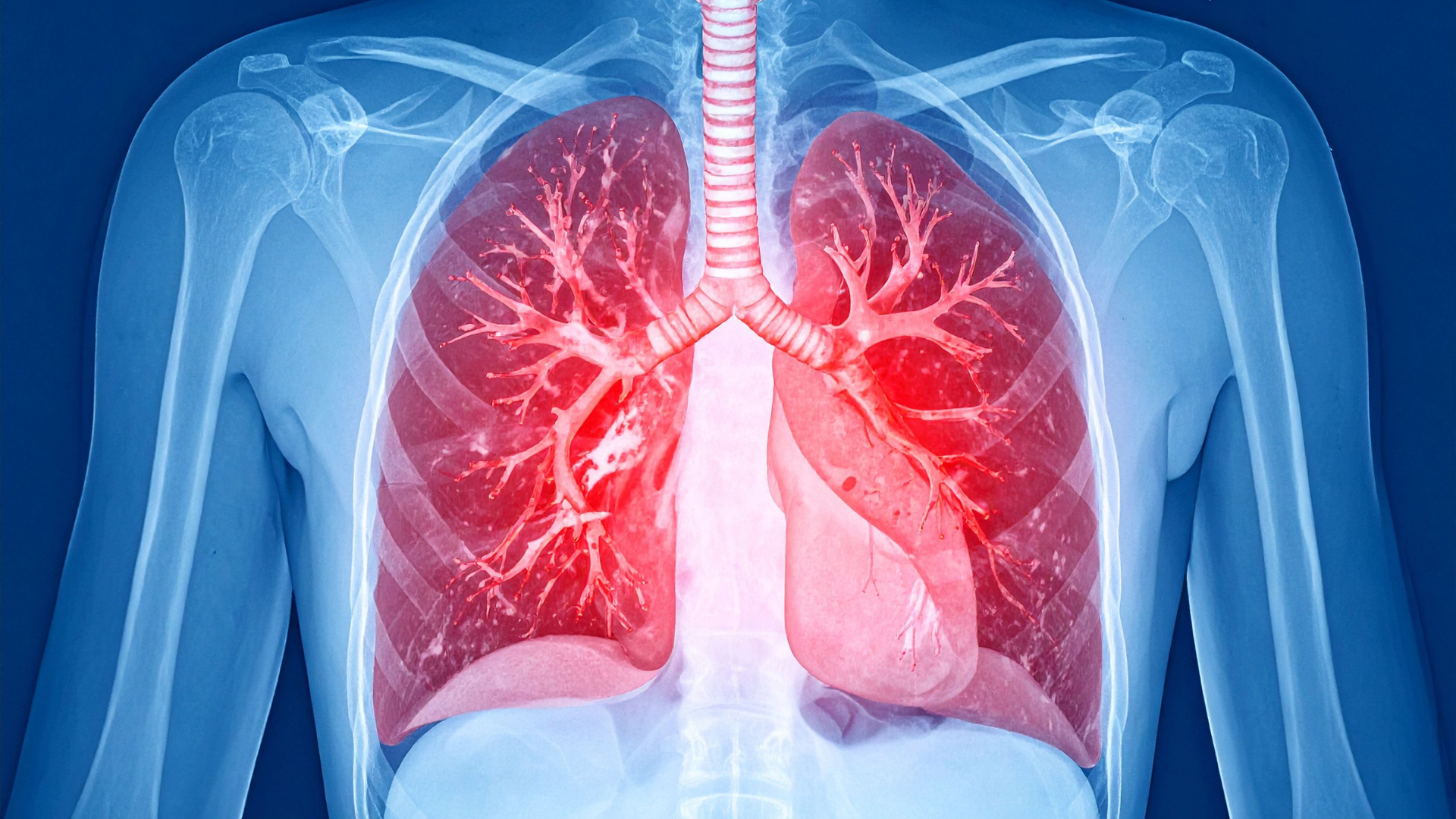 Brethezy Digital Lung Mapping